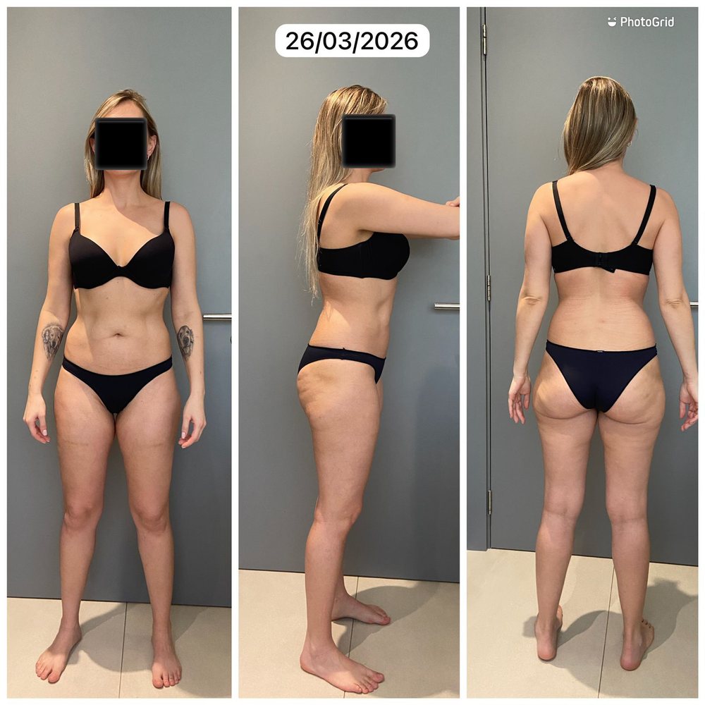 A mesma aluna do Barriga Detox — registro de depois, 26 de março de 2026