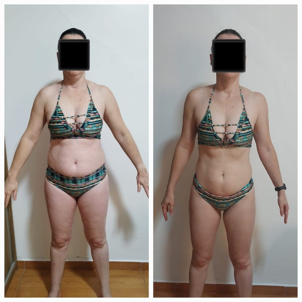 Antes e depois de aluna do Barriga Detox — vista de frente
